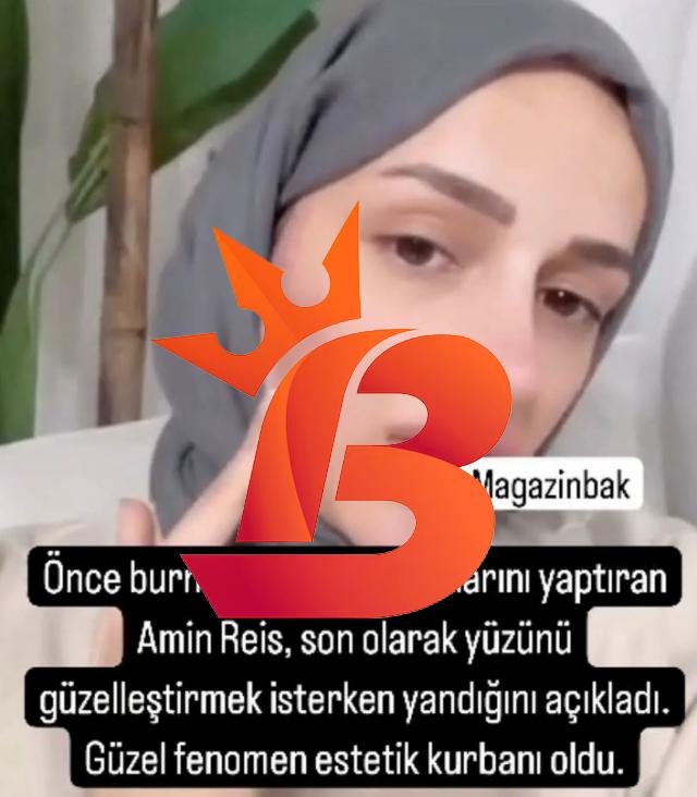 'Amin Reis' lakaplı fenomenin yüzü yandı